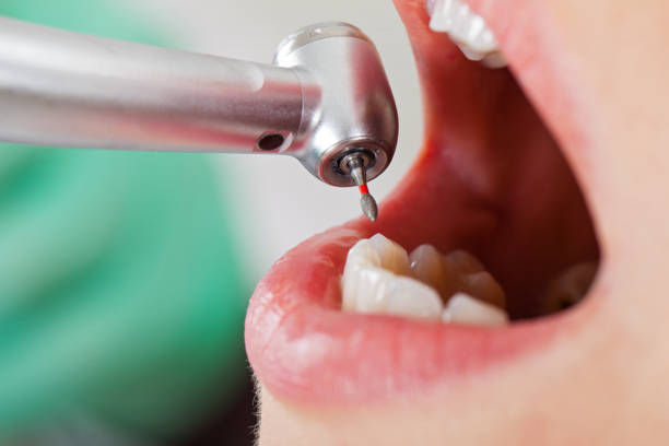 Best Emergency Tooth Extraction in Thiensville, WI